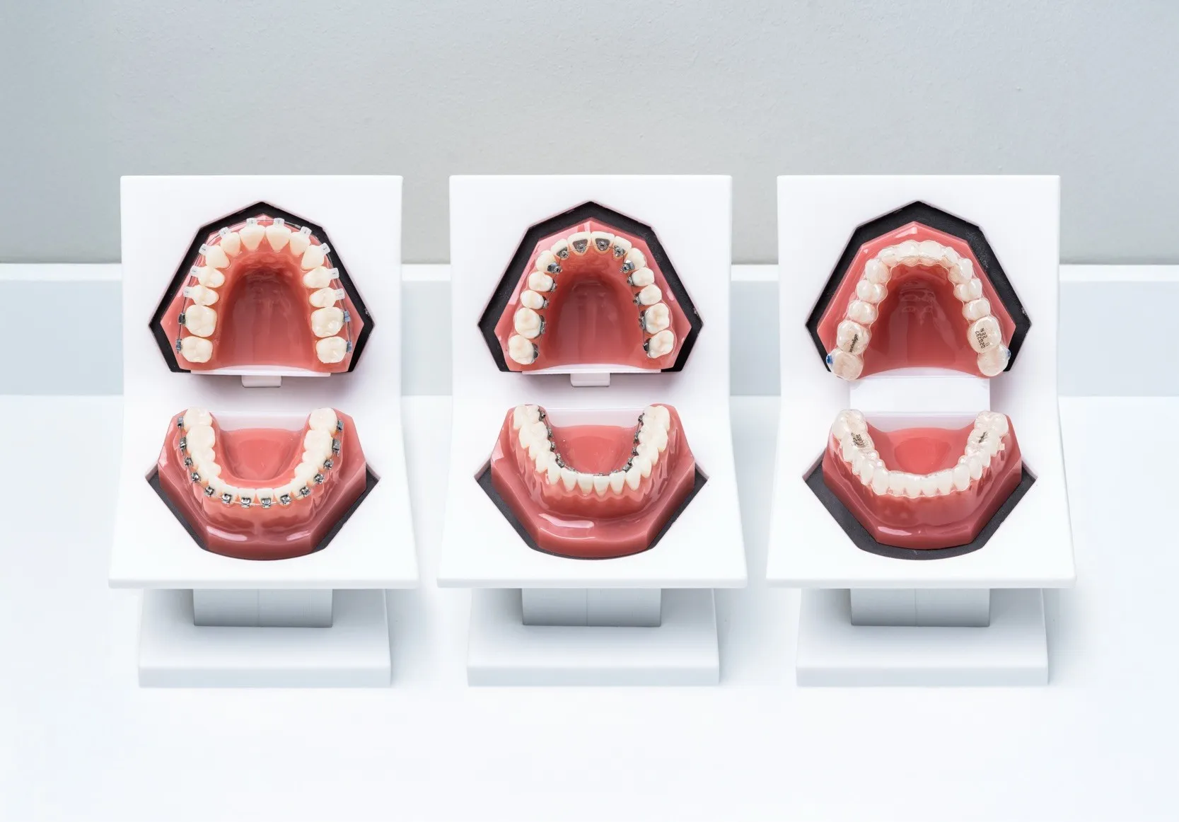 Moderne Behandlungsoptionen für berufstätige Erwachsene in Dresden